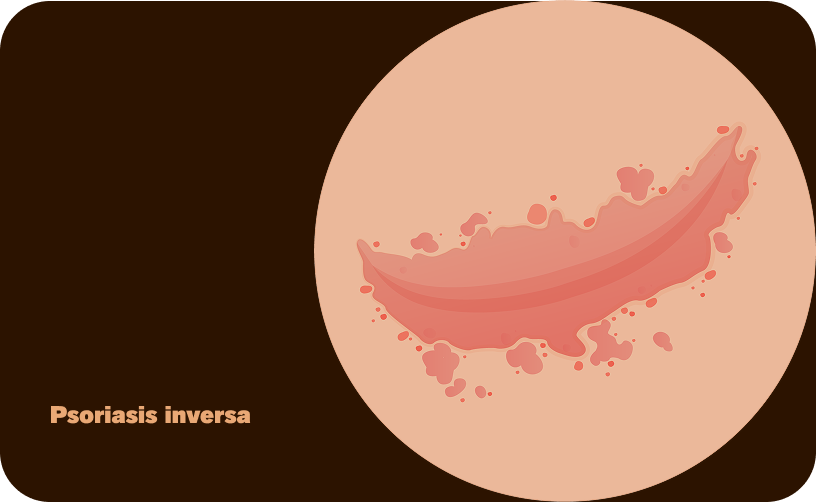 Inversa-DE-ohne Text